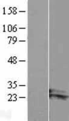 Western Blot: ARL14 Overexpression Lysate [NBL1-07690]