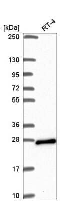 Western Blot: ARL15 Antibody [NBP2-56877]