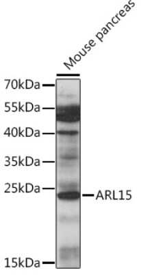 Western Blot: ARL15 AntibodyAzide and BSA Free [NBP2-92298]