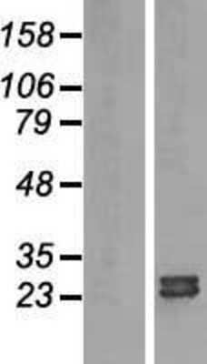 Western Blot: ARL15 Overexpression Lysate [NBL1-07691]