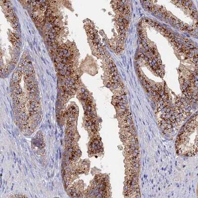 Immunohistochemistry-Paraffin: ARL16 Antibody [NBP1-94157]