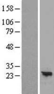 Western Blot: ARL16 Overexpression Lysate [NBP2-08541]