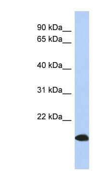 Western Blot: ARL17 Antibody [NBP1-70411]