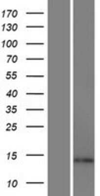 Western Blot: ARL17 Overexpression Lysate [NBP2-11285]