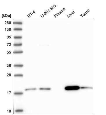 Western Blot: ARL17A Antibody [NBP2-59794]