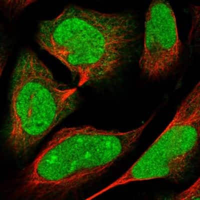 Immunocytochemistry/ Immunofluorescence: ARL2 Antibody [NBP1-91680]