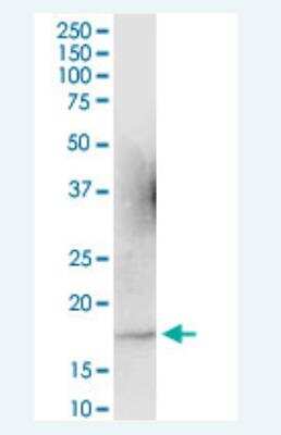 Western Blot: ARL2 Antibody [H00000402-B01P-50ug]