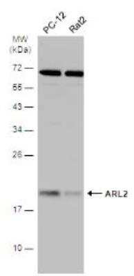 Western Blot: ARL2 Antibody [NBP1-30939]