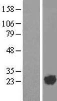 Western Blot: ARL2 Overexpression Lysate [NBL1-07692]