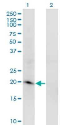 Western Blot: ARL2BP Antibody (2G6) [H00023568-M03]