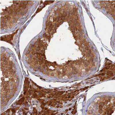 Immunohistochemistry: ARL2BP Antibody [NBP2-30477]