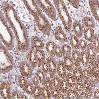 Immunohistochemistry: ARL2BP Antibody [NBP2-30681]