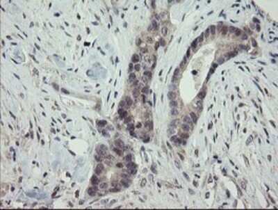 Immunohistochemistry: ARL2BP Antibody (OTI1A10) [NBP2-46541]