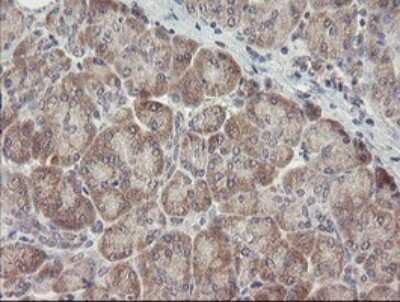 Immunohistochemistry: ARL2BP Antibody (OTI1A10) [NBP2-46541]