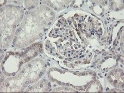 Immunohistochemistry: ARL2BP Antibody (OTI1A10) [NBP2-46541]