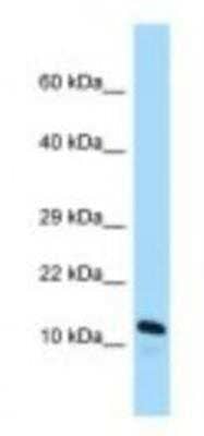 Western Blot: ARL2BP Antibody [NBP1-98397]