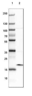 Western Blot: ARL2BP Antibody [NBP2-30477]