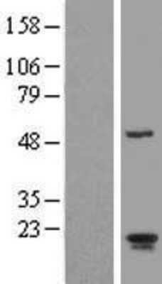 Western Blot: ARL2BP Overexpression Lysate [NBL1-07693]