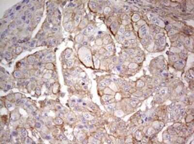 Immunohistochemistry: ARL3 Antibody (OTI1C6) [NBP2-46542]