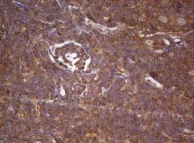 Immunohistochemistry: ARL3 Antibody (OTI1C6) [NBP2-46542]