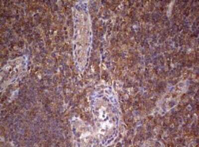 Immunohistochemistry: ARL3 Antibody (OTI1C6) [NBP2-46542]