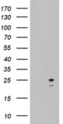 Western Blot: ARL3 Antibody (OTI1C6) [NBP2-46542]