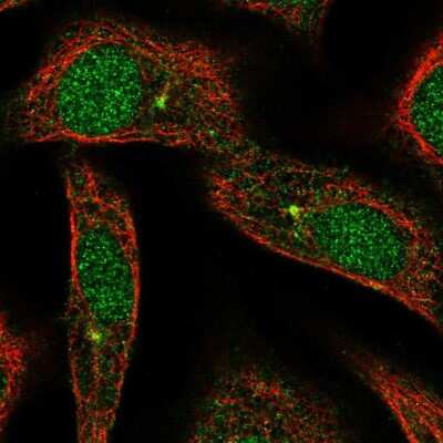 Immunocytochemistry/ Immunofluorescence: ARL3 Antibody [NBP2-57304]