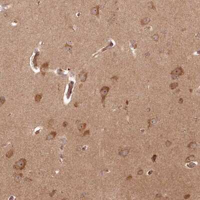 Immunohistochemistry-Paraffin: ARL3 Antibody [NBP1-88839]