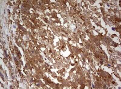 Immunohistochemistry: ARL3 Antibody (OTI1C6) - Azide and BSA Free [NBP2-70206]