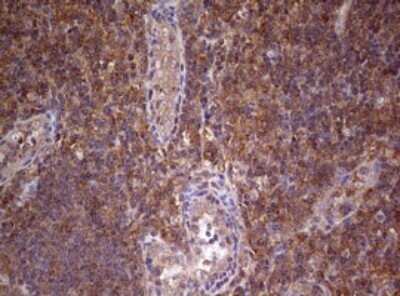 Immunohistochemistry: ARL3 Antibody (OTI1C6) - Azide and BSA Free [NBP2-70206]