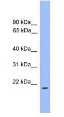 Western Blot: ARL3 Antibody [NBP1-69096]