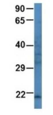 Western Blot: ARL3 Antibody [NBP1-69096]