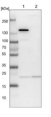 Western Blot: ARL3 Antibody [NBP1-88839]