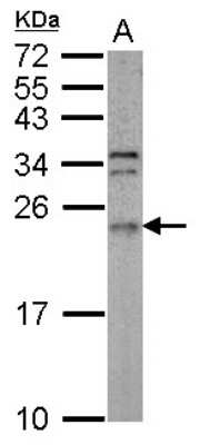 Western Blot: ARL3 Antibody [NBP2-15464]