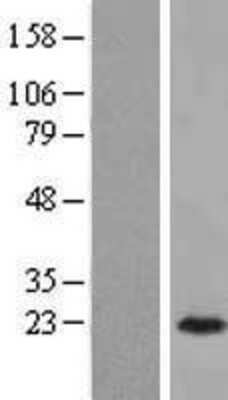 Western Blot: ARL3 Overexpression Lysate [NBL1-07694]