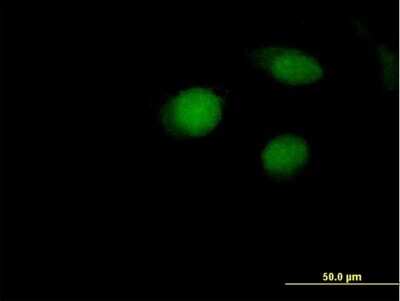 Immunocytochemistry/ Immunofluorescence: ARL4 Antibody [H00010124-B01P]