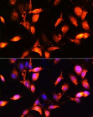Immunocytochemistry/ Immunofluorescence: ARL4 Antibody - Azide and BSA Free [NBP3-03356]