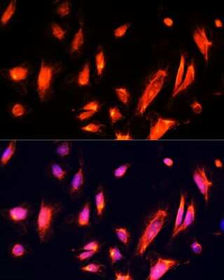 Immunocytochemistry/ Immunofluorescence: ARL4 Antibody - Azide and BSA Free [NBP3-03356]