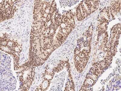 Immunohistochemistry-Paraffin: ARL4 Antibody [NBP2-99456]