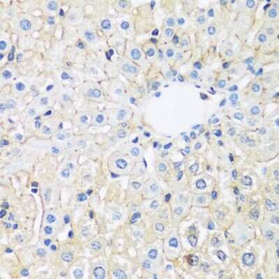 Immunohistochemistry-Paraffin: ARL4 Antibody - Azide and BSA Free [NBP3-03356]