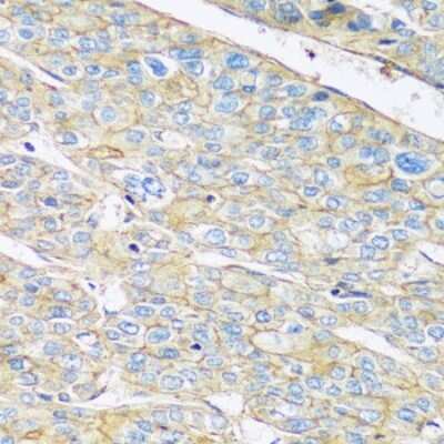 Immunohistochemistry-Paraffin: ARL4 Antibody - Azide and BSA Free [NBP3-03356]