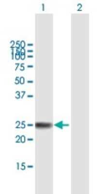 Western Blot: ARL4 Antibody [H00010124-B01P]