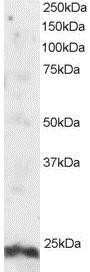 Western Blot: ARL4 Antibody [NB100-1080]