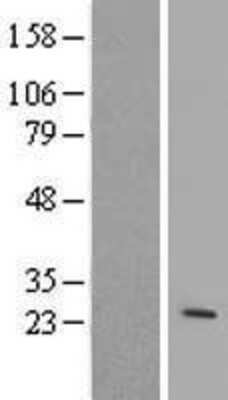 Western Blot: ARL4 Overexpression Lysate [NBL1-07695]