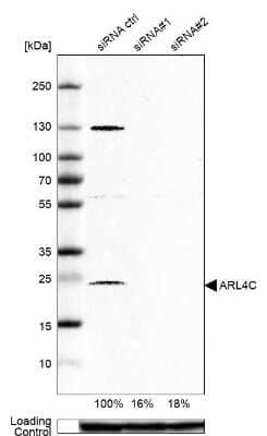 Western Blot: ARL4C Antibody [NBP1-88988]