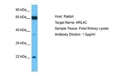 Western Blot: ARL4C Antibody [NBP2-82554]