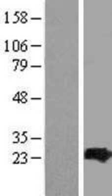 Western Blot: ARL4C Overexpression Lysate [NBP2-07712]