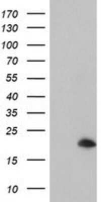 Western Blot: ARL5B Antibody (OTI2D7) [NBP2-01669]