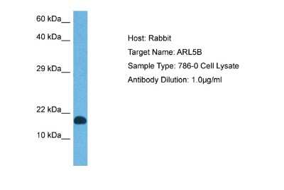 Western Blot: ARL5B Antibody [NBP2-83939]