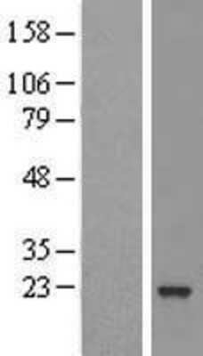 Western Blot: ARL5B Overexpression Lysate [NBL1-07698]